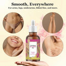 Cyperus Rotundus Moisturizing Hair Growth Inhibitor Oil