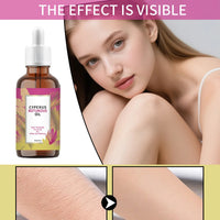 Cyperus Rotundus Moisturizing Hair Growth Inhibitor Oil