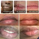 Dark Lip Lightening Balm and Exfoliating Moisturizer Mask