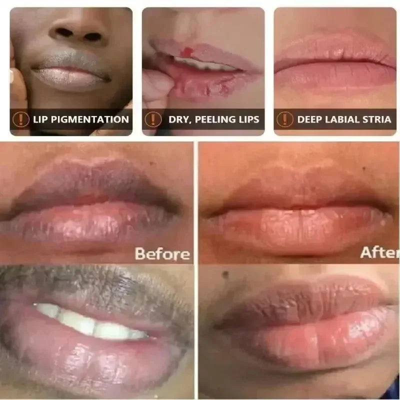 Dark Lip Lightening Balm and Exfoliating Moisturizing Treatment